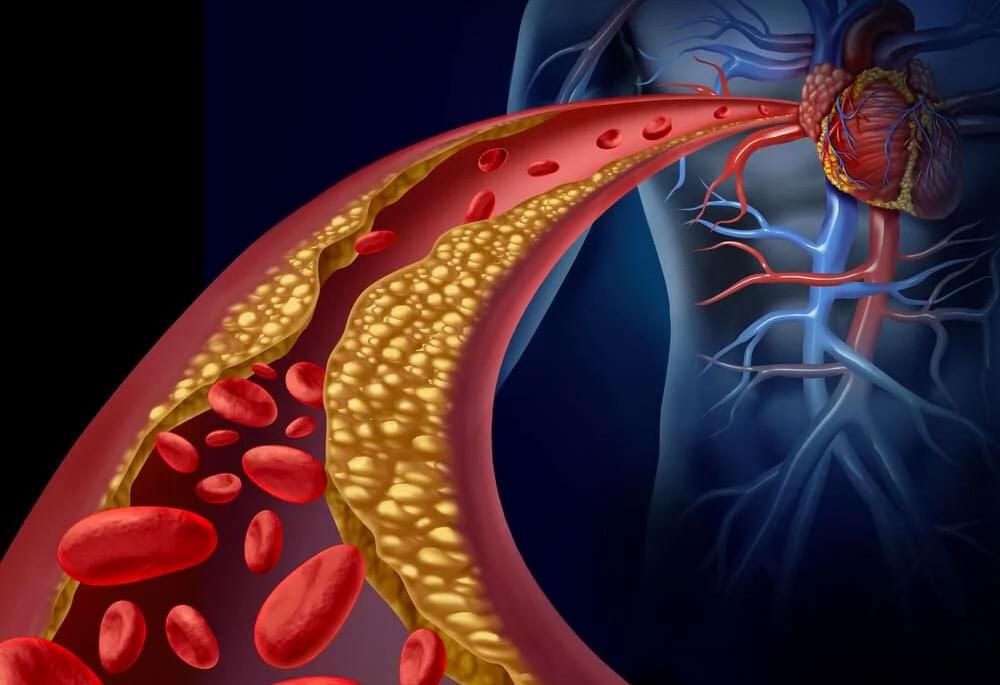 Food Revolution - Advanced Cholesterol Panel