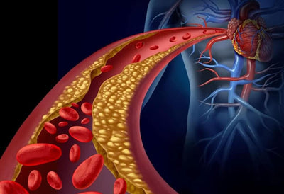 Advanced Cholesterol Panel